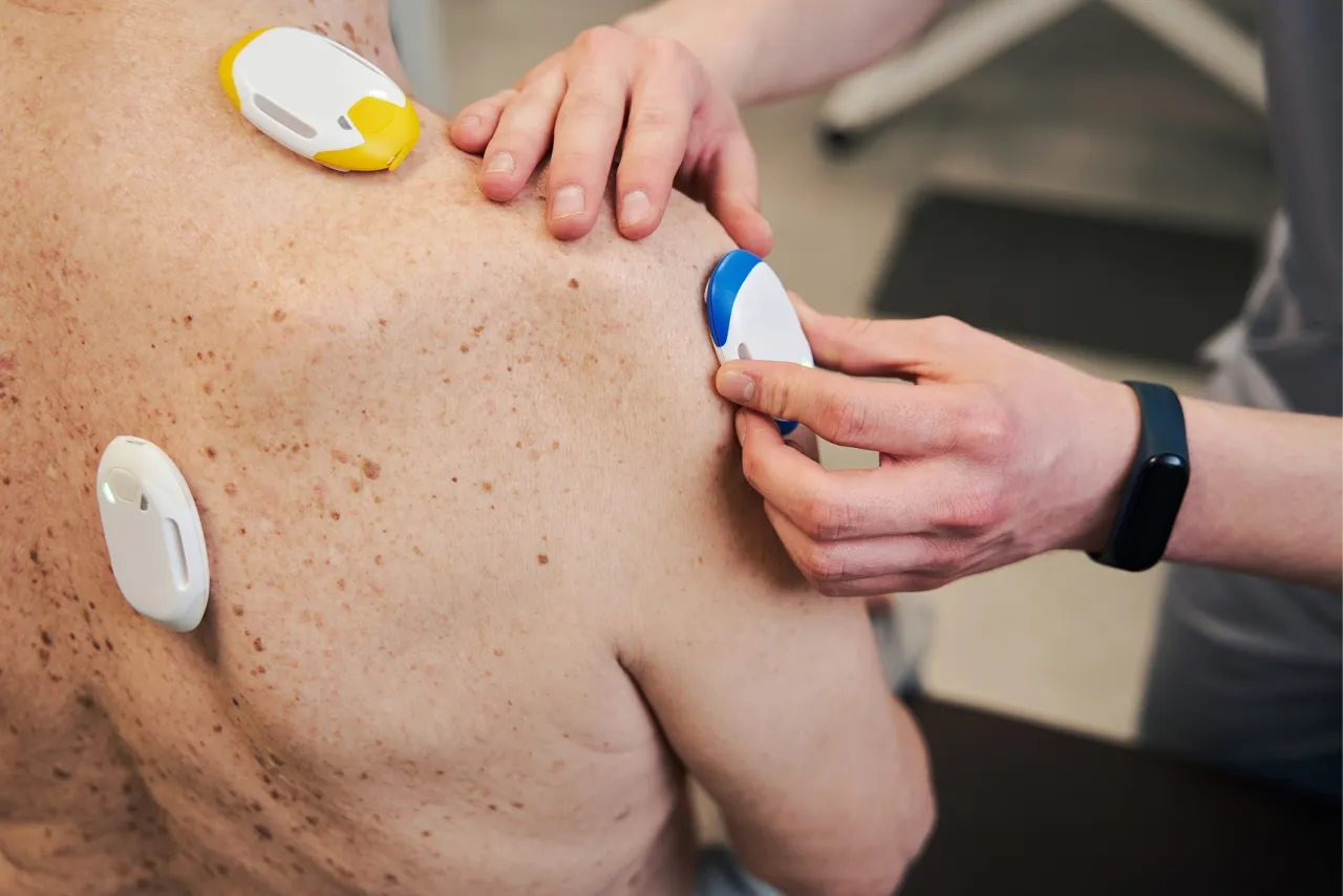 Allergologie in Rostock, allergische Hautreaktion am Unterarm eines Patienten